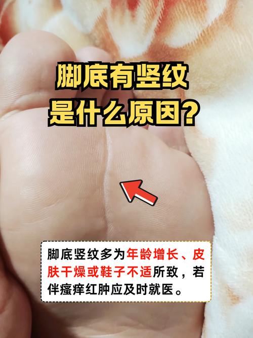 大富大貴腳底有豎紋