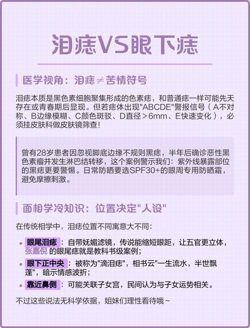 苦情痣與淚痣的區(qū)別是什么