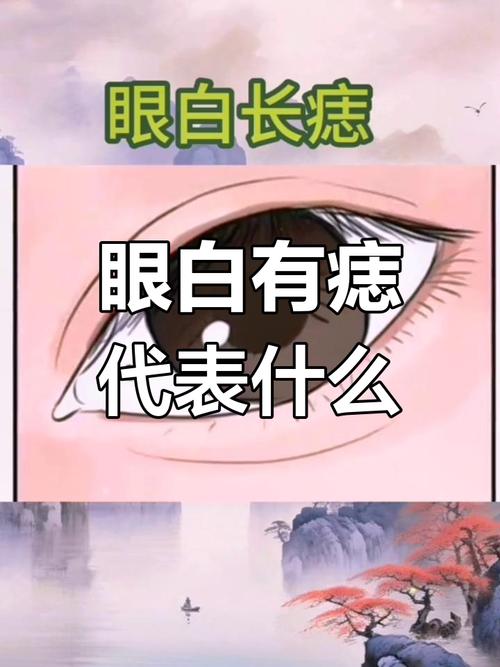 眼白長痣有什么寓意