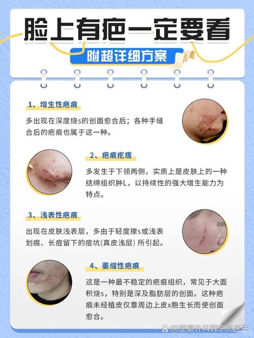 臉上有疤的不利與化解方法