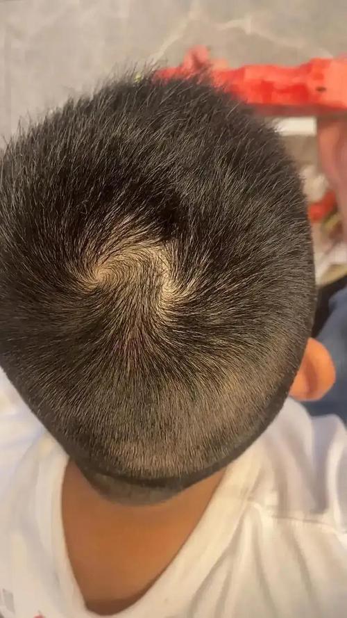 男人頭頂雙旋有什么說法？頭頂雙旋命運怎么樣？