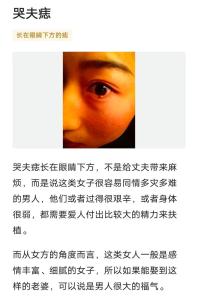 哭夫痣去掉好嗎