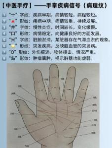 健康線意味著什么 健康線出現(xiàn)代表有大病嗎