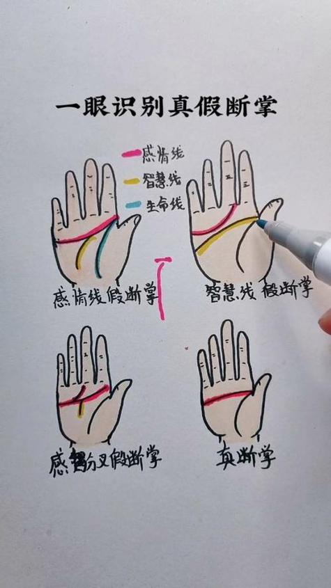 女人右手斷掌紋的命運好不好 女人斷掌詳解