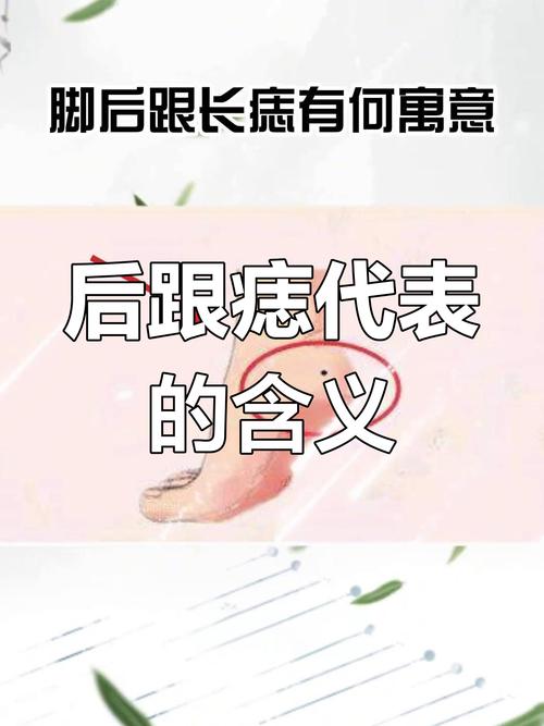 腳后跟有痣代表什么寓意