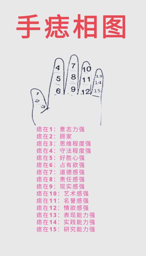 手上長痣代表什么 命運怎么樣
