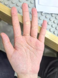 掌紋雜亂代表什么會有影響嗎