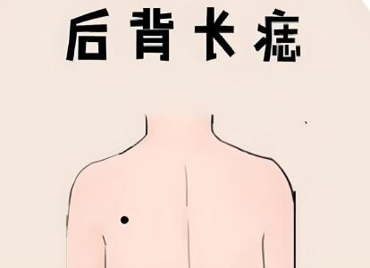 身體五大黃金痣的位置
