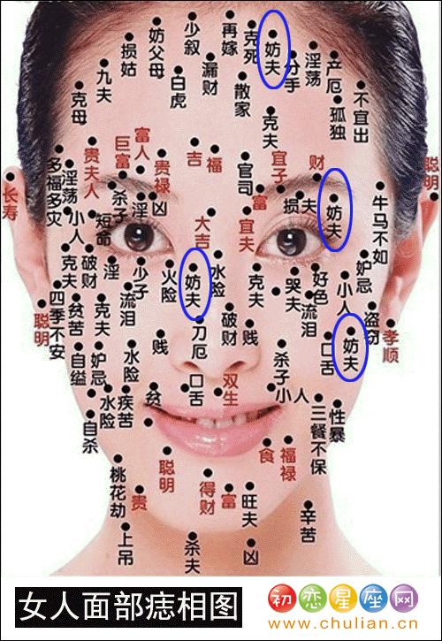 妨夫痣在哪里