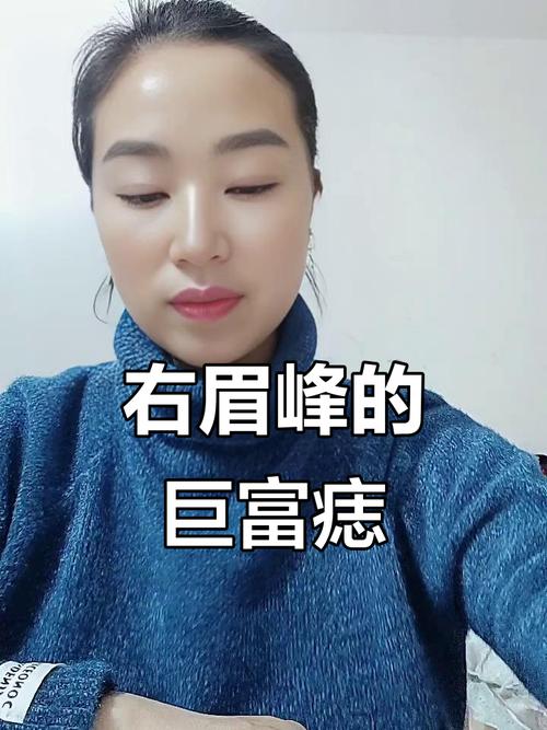右眉毛上方有痣