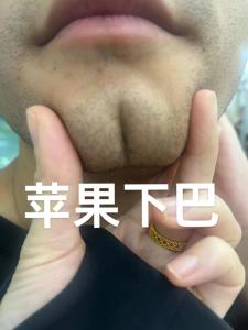 蘋果下巴是什么 是富貴相嗎