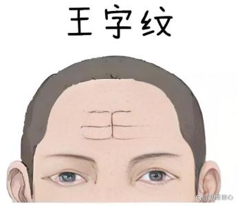 額頭王字紋