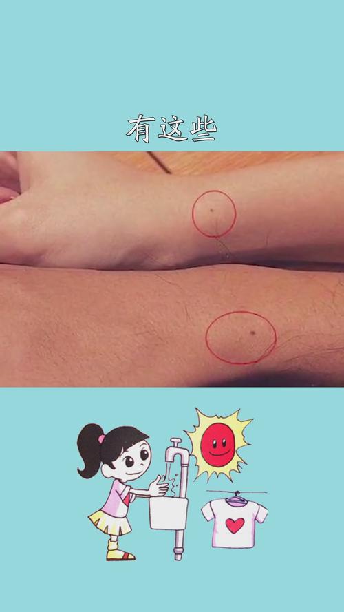青色的痣是吉痣嗎