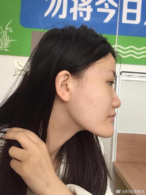 下巴翹好不好