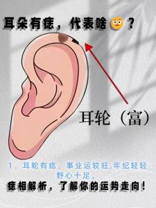 耳朵長痣，看出你一生運(yùn)勢(shì)