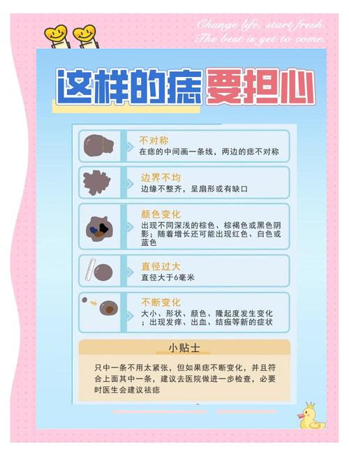 身上的痣對我們有何影響