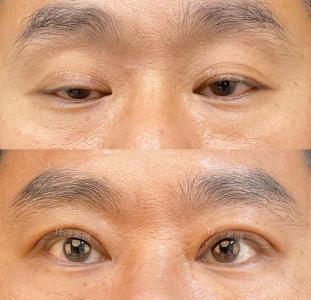 眼角下垂的男人面相好不好？
