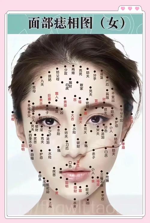 臉上長痣面相圖 不能點的痣