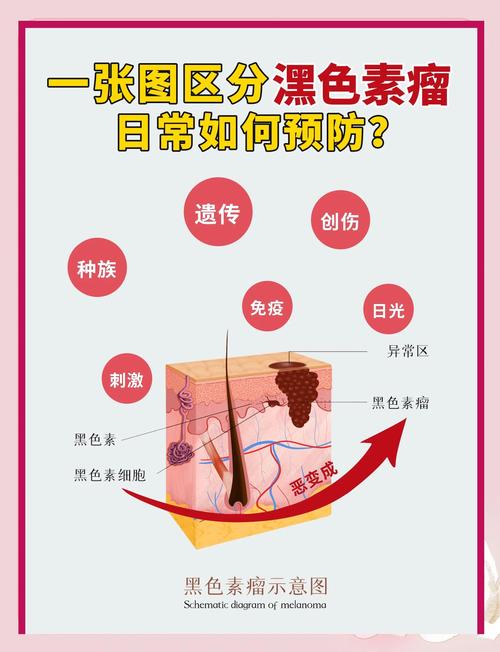 怎么分辨惡善痣