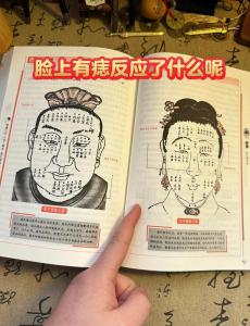 痣相評判之審痣篇