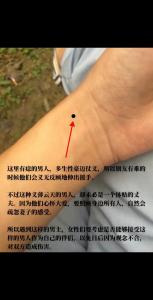 女人手腕有痣的命運(yùn)怎么樣