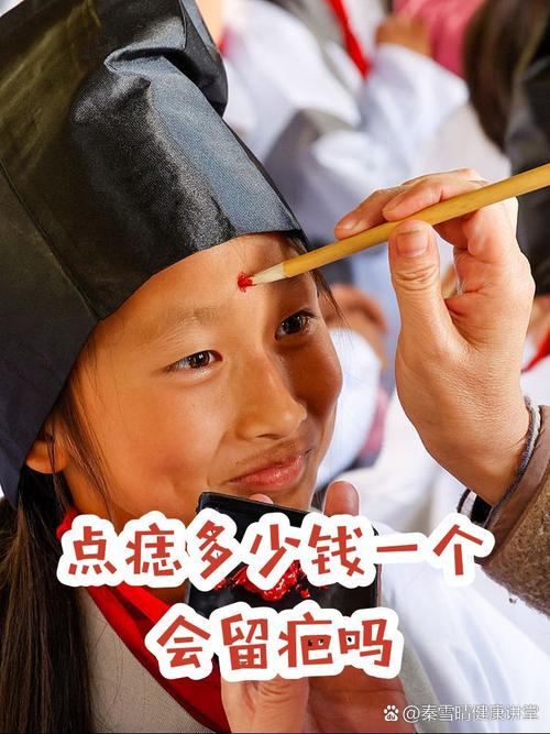 五顆痣決定人生成敗