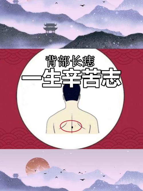長在背部的六顆福祿如意痣