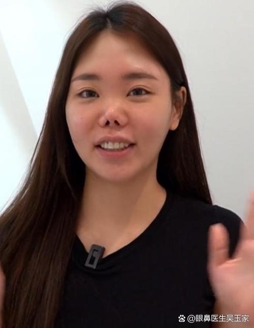 歪鼻子影響財運嗎