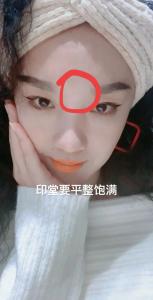 印堂飽滿是什么樣的,印堂飽滿圖片