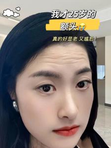 女人額頭中間一條豎紋 女人額頭紋分析