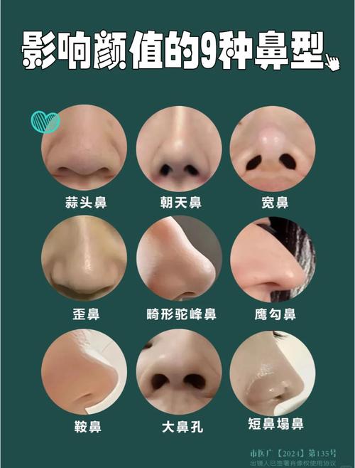 鼻子很高但是粗糙代表著什么呢