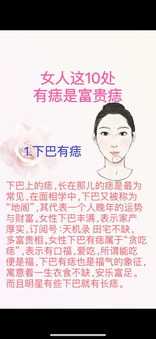 富貴痣 哪里長痣會有富貴命