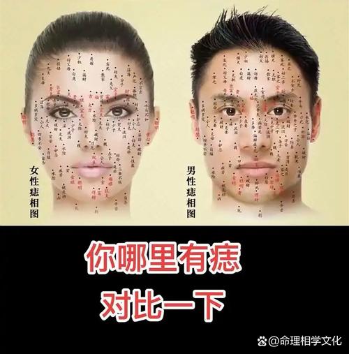 哪些痣會影響事業和感情