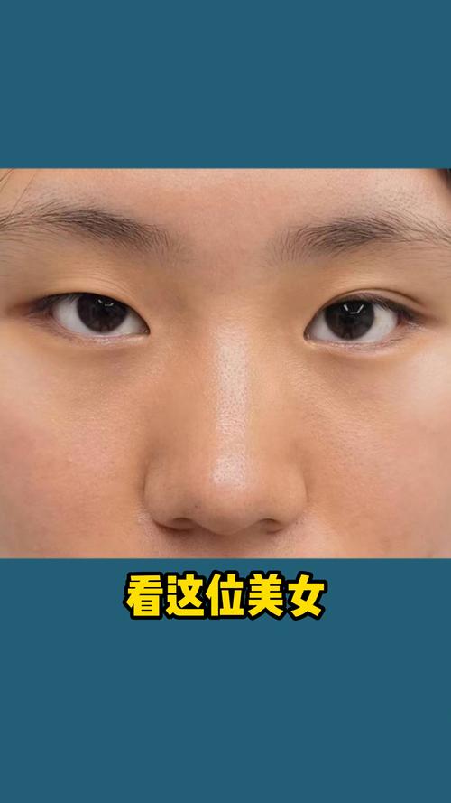 眼睛看相 女人眼睛一單一雙好嗎