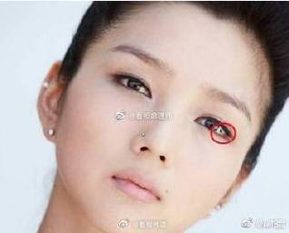 眼白有痣的女人好不好