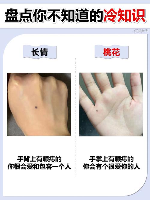 女人手背有痣好么