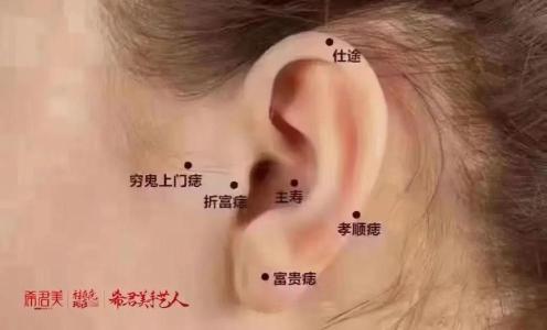 男人耳朵痣相圖解大全