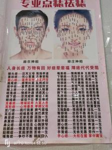 你的痣到底好不好