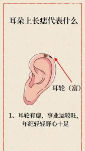 男人耳朵長痣代表什么
