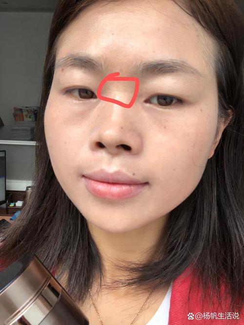 鼻梁橫紋的婚姻狀況