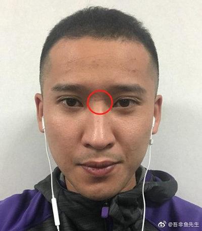 山根斷鼻歪斜的人運勢好嗎
