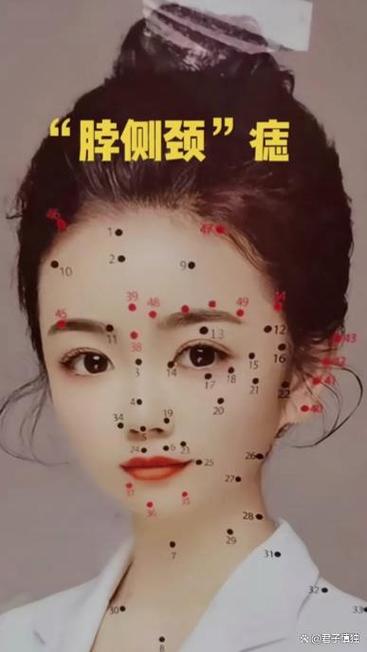 脖子上有痣的吉兇如何