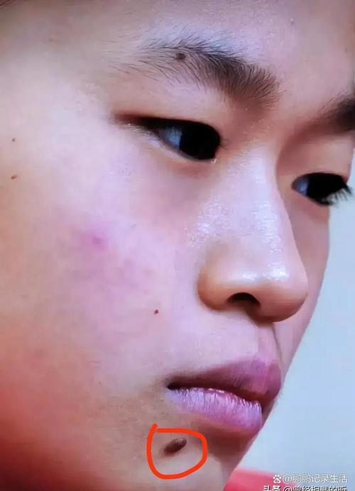 嘴唇長有痣的人怎么樣
