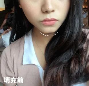 美人溝下巴的女人是不是容易離婚