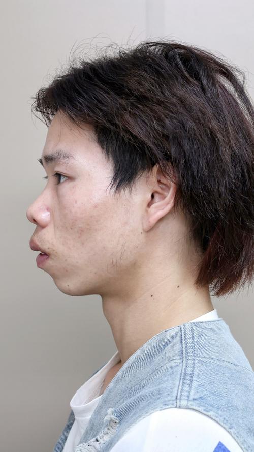 男人命硬的人有什么特征 錐子臉且嘴大牙齒凸出