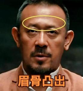 眉骨高額頭凹陷的男生