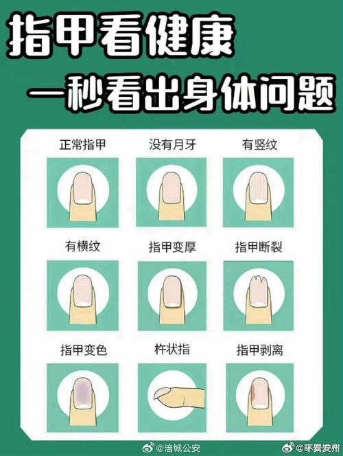 手指甲預示你的命運密碼