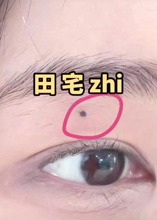 田宅宮長痣好不好 人身上的五大窮痣