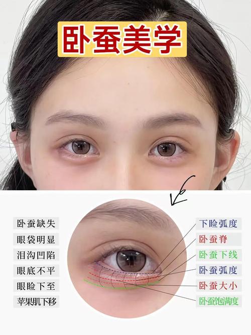臥蠶眼面相到底好不好 有什么說法