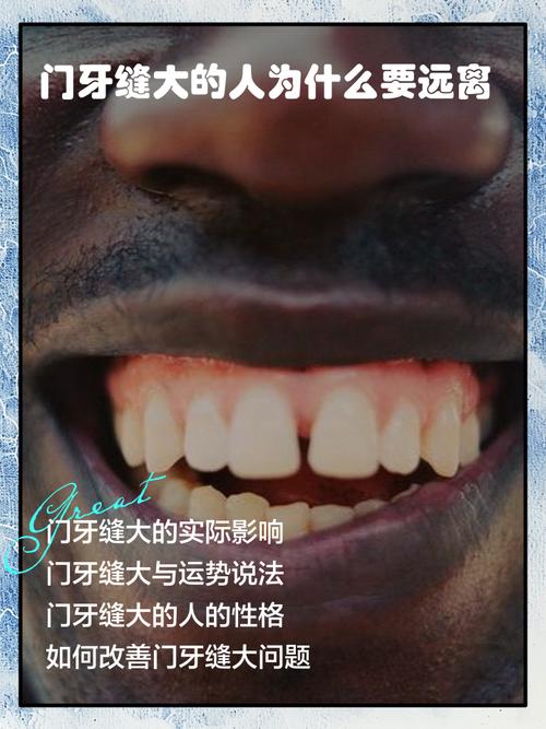 門牙大的人什么命？你知道嗎？